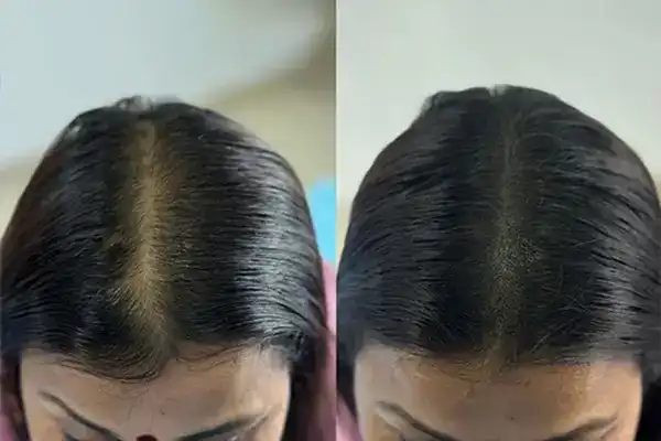 Best SMP in India – Scalpdots Result 3