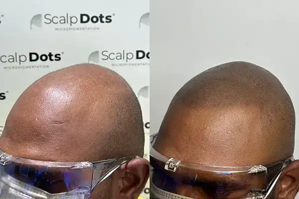 Best SMP in India – Scalpdots Result 4