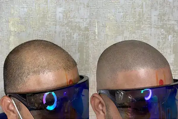 Best SMP in India – Scalpdots Result 6